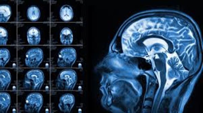 brain_stock